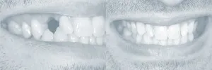 Smiles Gallery