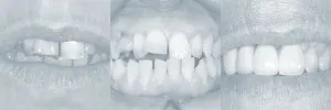 Smiles Gallery