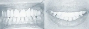 Smiles Gallery